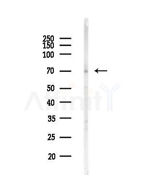 Phospho-YAP (Ser127) Antibody - Western blot analysis of lysates from HepG2 cells(heat-shock,45min treatment), using Phospho-YAP (Ser127) Antibody at 1/1000 dilution.