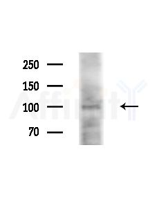 Phospho-c-PLA2 (Ser505) Antibody - Western blot analysis of extracts from Mouse liver, using Phospho-c-PLA2 (Ser505) Antibody at 1/1000 dilution.