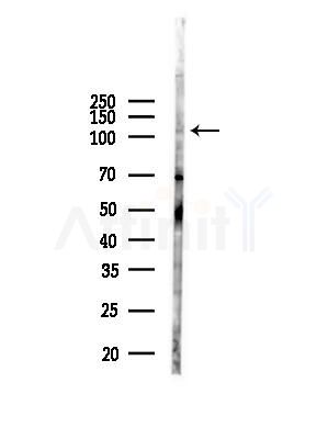 Phospho-c-PLA2 (Ser505) Antibody - Western blot analysis of lysates from Mouse liver, using Phospho-c-PLA2 (Ser505) Antibody at 1/1000 dilution.