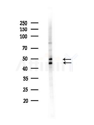 Phospho-GSK3 alpha/ beta (Tyr216/Tyr279) Antibody - Western blot analysis of lysates from Hela cells(heat-shock,45min treatment), using Phospho-GSK3 alpha/ beta (Tyr216/Tyr279) Antibody at 1/1000 dilution.