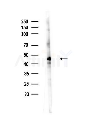 Phospho-GSK3 alpha/ beta (Tyr216/Tyr279) Antibody - Western blot analysis of lysates from Rat testis, using Phospho-GSK3 alpha/ beta (Tyr216/Tyr279) Antibody at 1/1000 dilution.