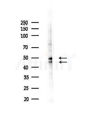 Phospho-GSK3 alpha/ beta (Tyr216/Tyr279) Antibody - Western blot analysis of lysates from LoVo cells(heat-shock, 45min treatment), using Phospho-GSK3 alpha/ beta (Tyr216/Tyr279) Antibody at 1/1000 dilution.