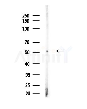 Phospho-GSK3 alpha (Ser21) Antibody - Western blot analysis of lysates from COLO205 cells(heat-shock,45min treatment), using Phospho-GSK3 alpha (Ser21) Antibody at 1/1000 dilution.