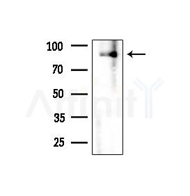 Phospho-STAT5B (Ser731) Antibody - Western blot analysis of extracts from COLO205 cells(heat-shock,45min treatment), using Phospho-STAT5B (Ser731) Antibody at 1/1000 dilution.