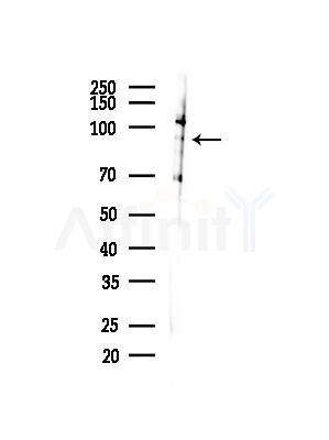 Phospho-STAT5B (Ser731) Antibody - Western blot analysis of lysates from COLO205 cells(heat-shock,45min treatment), using Phospho-STAT5B (Ser731) Antibody at 1/1000 dilution.