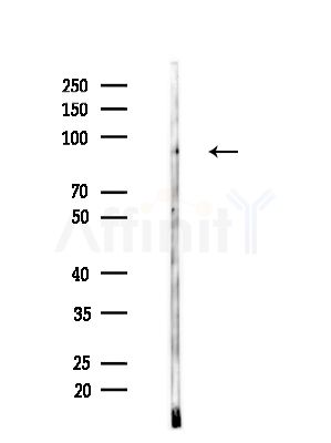 Phospho-STAT2 (Tyr690) Antibody - Western blot analysis of lysates from B16F10-LUC cells(starvation,24h treatment), using Phospho-STAT2 (Tyr690) Antibody at 1/1000 dilution.