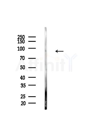 Phospho-STAT2 (Tyr690) Antibody - Western blot analysis of lysates from EC304 cells, using Phospho-STAT2 (Tyr690) Antibody at 1/1000 dilution.