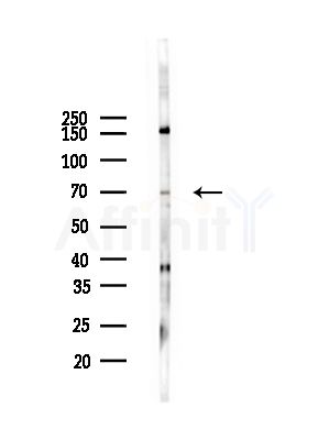 Phospho-LIMK1/2 (Thr508/Thr505) Antibody - Western blot analysis of lysates from COLO205 cells(heat-shock,45min treatment), using Phospho-LIMK1/2 (Thr508/Thr505) Antibody at 1/1000 dilution.
