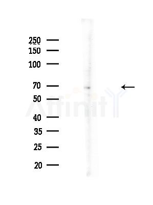 Phospho-LIMK1 (Thr508) Antibody - Western blot analysis of lysates from Hela cells(heat-shock,45min treatment), using Phospho-LIMK1 (Thr508) Antibody at 1/1000 dilution.