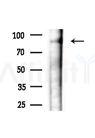 Phospho-Ataxin 1 (Ser775) Antibody - Western blot analysis of extracts from Rat brain, using Phospho-Ataxin 1 (Ser775) Antibody at 1/1000 dilution.