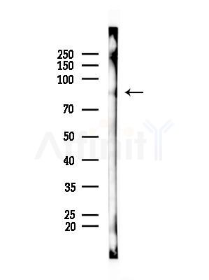 Phospho-Ataxin 1 (Ser775) Antibody - Western blot analysis of lysates from Rat brain, using Phospho-Ataxin 1 (Ser775) Antibody at 1/1000 dilution.