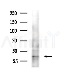 Phospho-Caspase 9 (Thr125) Antibody - Western blot analysis of extracts from Mouse liver, using Phospho-Caspase 9 (Thr125) Antibody at 1/1000 dilution.
