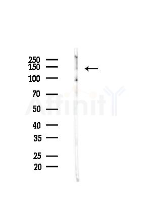 Phospho-HDAC4 (Ser632) Antibody - Western blot analysis of lysates from B16F10-LUC cells(starvation,24h treatment), using Phospho-HDAC4 (Ser632) Antibody at 1/1000 dilution.