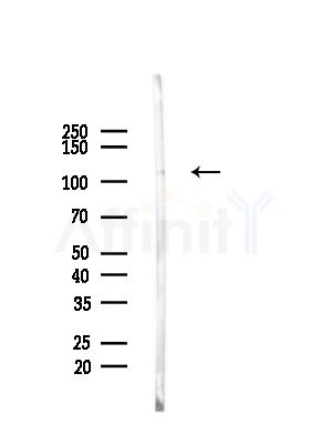Phospho-HDAC4 (Ser632) Antibody - Western blot analysis of lysates from EC304 cells, using Phospho-HDAC4 (Ser632) Antibody at 1/1000 dilution.