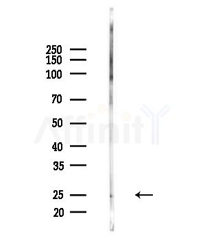 Phospho-RhoA (Ser188) Antibody - Western blot analysis of lysates from Mouse brain, using Phospho-RhoA (Ser188) Antibody at 1/1000 dilution.