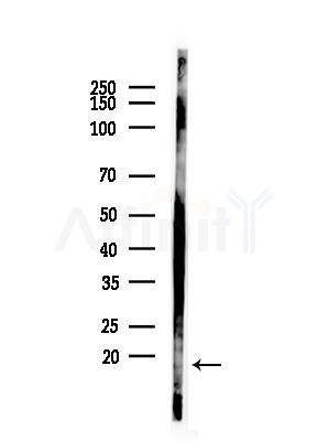 Phospho-Calmodulin1/2/3 (Thr79+Ser81)[Thr80+Ser82] Antibody - Western blot analysis of lysates from COLO205 cells(heat-shock,45min treatment), using Phospho-Calmodulin1/2/3 (Thr79+Ser81)[Thr80+Ser82] Antibody at 1/1000 dilution.
