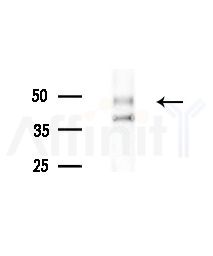 Phospho-Smad3 (Ser204) Antibody - Western blot analysis of lysates from MCF7 cells(heat-shock,45min treatment), using Phospho-Smad3 (Ser204) Antibody at 1/1000 dilution.