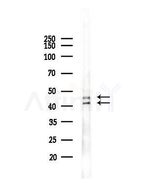 Phospho-Smad3 (Ser204) Antibody - Western blot analysis of lysates from MCF7 cells(heat-shock,45min treatment), using Phospho-Smad3 (Ser204) Antibody at 1/1000 dilution.
