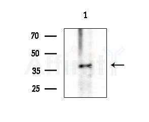Phospho-Smad3 (Ser208) Antibody - Western blot analysis of extracts from HepG2 cells(heat-shock treatment), using Phospho-Smad3 (Ser208) Antibody at 1/1000 dilution.
