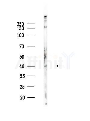 Phospho-Smad3 (Ser208) Antibody - Western blot analysis of lysates from HepG2 cells(heat-shock,45min treatment), using Phospho-Smad3 (Ser208) Antibody at 1/1000 dilution.