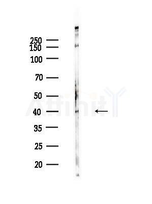 Phospho-Smad3 (Ser208) Antibody - Western blot analysis of lysates from HepG2 cells(heat-shock,45min treatment), using Phospho-Smad3 (Ser208) Antibody at 1/1000 dilution.