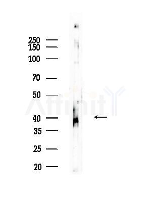 Phospho-Smad3 (Ser213) Antibody - Western blot analysis of lysates from HepG2 cells(heat-shock,45min treatment), using Phospho-Smad3 (Ser213) Antibody at 1/1000 dilution.