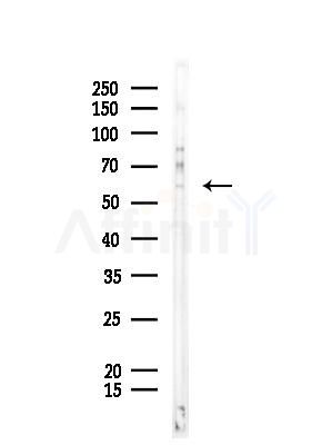 Phospho-Smad2/3 (Thr8) Antibody - Western blot analysis of lysates from COLO205 cells, using Phospho-Smad2/3 (Thr8) Antibody at 1/1000 dilution.