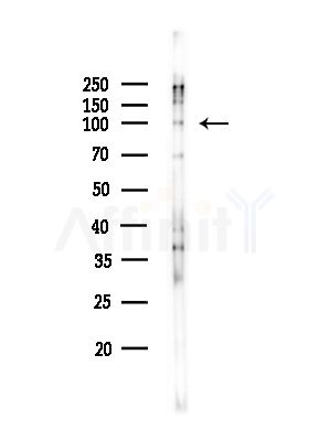 Phospho-NF kappaB p100/p52 (Ser866) Antibody - Western blot analysis of lysates from COLO205 cells(heat-shock,45min treatment), using Phospho-NF kappaB p100/p52 (Ser866) Antibody at 1/1000 dilution.