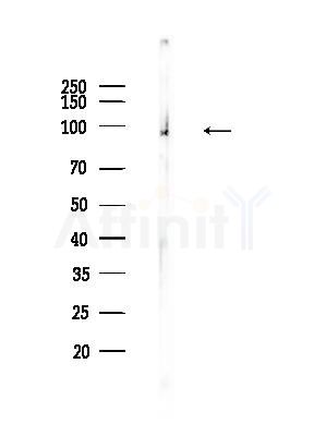 Phospho-NF kappaB p100/p52 (Ser870) Antibody - Western blot analysis of lysates from Mouse testis, using Phospho-NF kappaB p100/p52 (Ser870) Antibody at 1/1000 dilution.