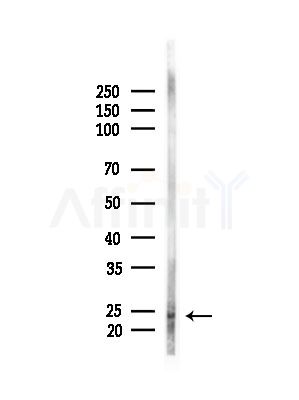 Phospho-Caveolin 1 (Tyr14) Antibody - Western blot analysis of lysates from RAW264.
