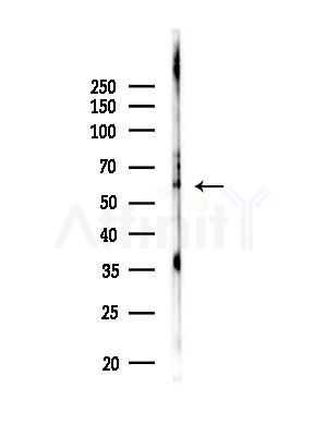 Phospho-NF-kB p65 (Thr254) Antibody - Western blot analysis of lysates from Mouse brain, using Phospho-NF-kB p65 (Thr254) Antibody at 1/1000 dilution.