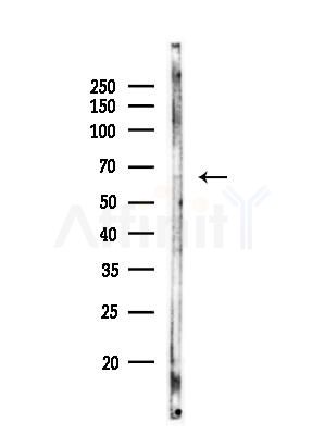 Phospho-NF-kB p65 (Thr435) Antibody - Western blot analysis of lysates from Mouse brain, using Phospho-NF-kB p65 (Thr435) Antibody at 1/1000 dilution.