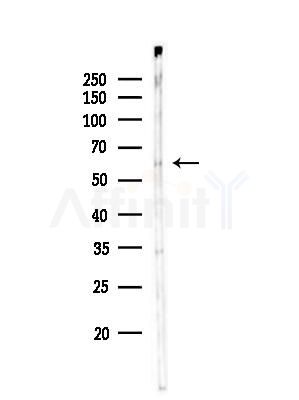 Phospho-NF-kB p65 (Ser281) Antibody - Western blot analysis of lysates from COLO205 cells, using Phospho-NF-kB p65 (Ser281) Antibody at 1/1000 dilution.