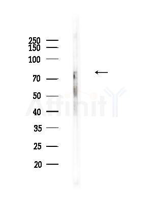Phospho-PKC theta (Ser676) Antibody - Western blot analysis of lysates from Mouse testis, using Phospho-PKC theta (Ser676) Antibody at 1/1000 dilution.