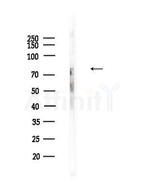 Phospho-PKC theta (Ser676) Antibody - Western blot analysis of lysates from Mouse testis, using Phospho-PKC theta (Ser676) Antibody at 1/1000 dilution.