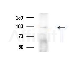 Phospho-Dynamin 1 (Ser774) Antibody - Western blot analysis of extracts from B16F10-LUC cells(heat-shock,45min treatment), using Phospho-Dynamin 1 (Ser774) Antibody at 1/1000 dilution.