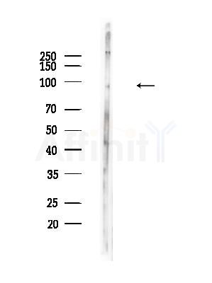 Phospho-Dynamin 1 (Ser774) Antibody - Western blot analysis of lysates from B16F10-LUC cells(heat-shock,45min treatment), using Phospho-Dynamin 1 (Ser774) Antibody at 1/1000 dilution.