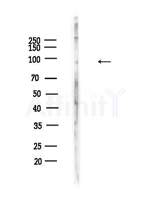 Phospho-Dynamin 1 (Ser774) Antibody - Western blot analysis of lysates from B16F10-LUC cells(heat-shock,45min treatment), using Phospho-Dynamin 1 (Ser774) Antibody at 1/1000 dilution.