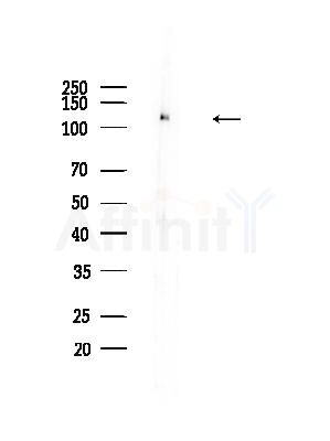 Phospho-FAK (Tyr576) Antibody - Western blot analysis of lysates from Mouse testis, using Phospho-FAK (Tyr576) Antibody at 1/1000 dilution.