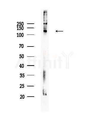 Phospho-FAK (Ser843) Antibody - Western blot analysis of lysates from HepG2 cells(heat-shock treatment), using Phospho-FAK (Ser843) Antibody at 1/1000 dilution.