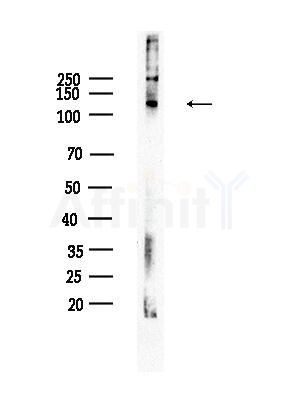 Phospho-FAK (Ser843) Antibody - Western blot analysis of lysates from HepG2 cells(heat-shock treatment), using Phospho-FAK (Ser843) Antibody at 1/1000 dilution.