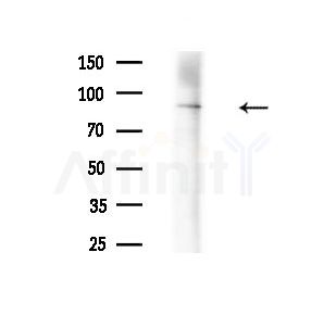 Phospho-HSL (Ser855/Ser554) Antibody - Western blot analysis of extracts from B16F10-LUC cells(heat-shock treatment), using Phospho-HSL (Ser855/Ser554) Antibody at 1/1000 dilution.