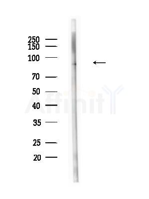 Phospho-HSL (Ser855/Ser554) Antibody - Western blot analysis of lysates from B16F10-LUC cells(heat-shock,45min treatment), using Phospho-HSL (Ser855/Ser554) Antibody at 1/1000 dilution.