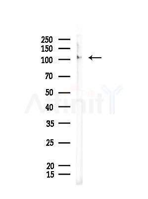 Phospho-NMDAR1 (Ser890) Antibody - Western blot analysis of lysates from EC304 cells, using Phospho-NMDAR1 (Ser890) Antibody at 1/1000 dilution.