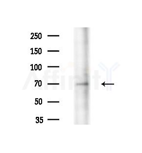 Phospho-SHP2 (Tyr542)[Tyr546] Antibody - Western blot analysis of lysates from Raji cells(heat-shock,45min treatment), using Phospho-SHP2 (Tyr542)[Tyr546] Antibody at 1/1000 dilution.