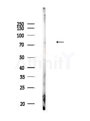 Phospho-SHP2 (Tyr542)[Tyr546] Antibody - Western blot analysis of lysates from Raji cells(heat-shock,45min treatment), using Phospho-SHP2 (Tyr542)[Tyr546] Antibody at 1/1000 dilution.
