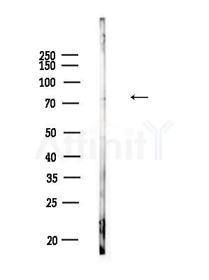 Phospho-SHP2 (Tyr542)[Tyr546] Antibody - Western blot analysis of lysates from Raji cells(heat-shock,45min treatment), using Phospho-SHP2 (Tyr542)[Tyr546] Antibody at 1/1000 dilution.