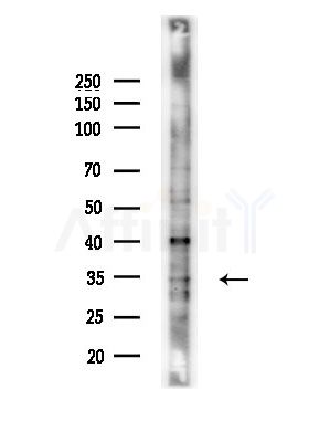 Phospho-BCL-XL (Thr47) Antibody - Western blot analysis of lysates from LoVo cells(heat-shock, 45min treatment), using Phospho-BCL-XL (Thr47) Antibody at 1/1000 dilution.