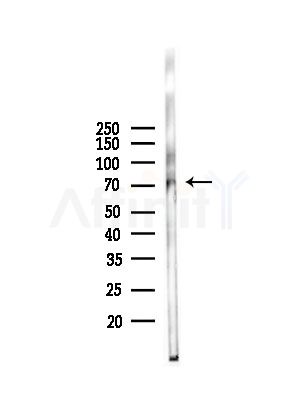 Phospho-FOXO1A (Ser256) Antibody - Western blot analysis of lysates from Mouse liver, using Phospho-FOXO1A (Ser256) Antibody at 1/1000 dilution.