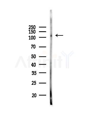Phospho-NFAT4 (Ser165) Antibody - Western blot analysis of lysates from PC12 cells, using Phospho-NFAT4 (Ser165) Antibody at 1/1000 dilution.